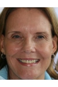Konig Center for Cosmetic & Comprehensive Dentistry smile photos